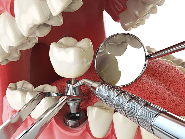 Best Emergency Denture Repair in Albany, TX